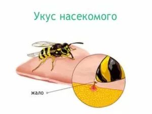 аллергия на яд насекомых